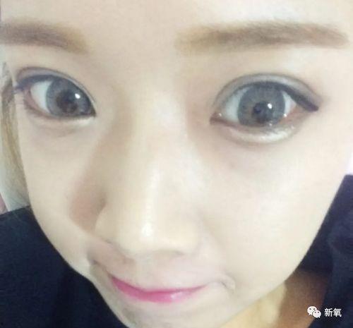 网红大鼻孔,独特魅力背后的故事